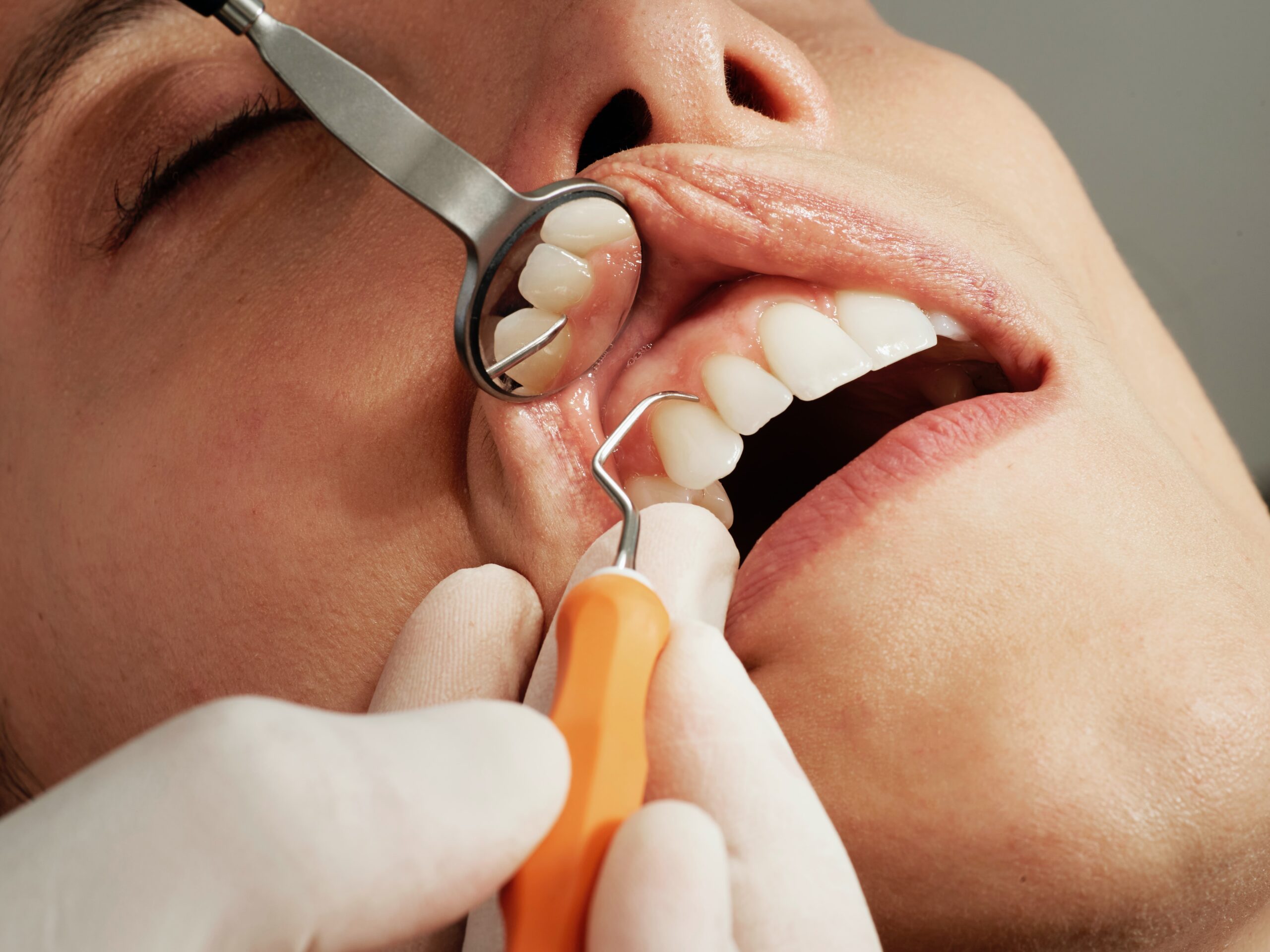 How often should I get my teeth cleaned?